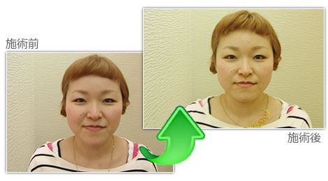 �g�[�^���r���[�e�B�[�T���� ARK